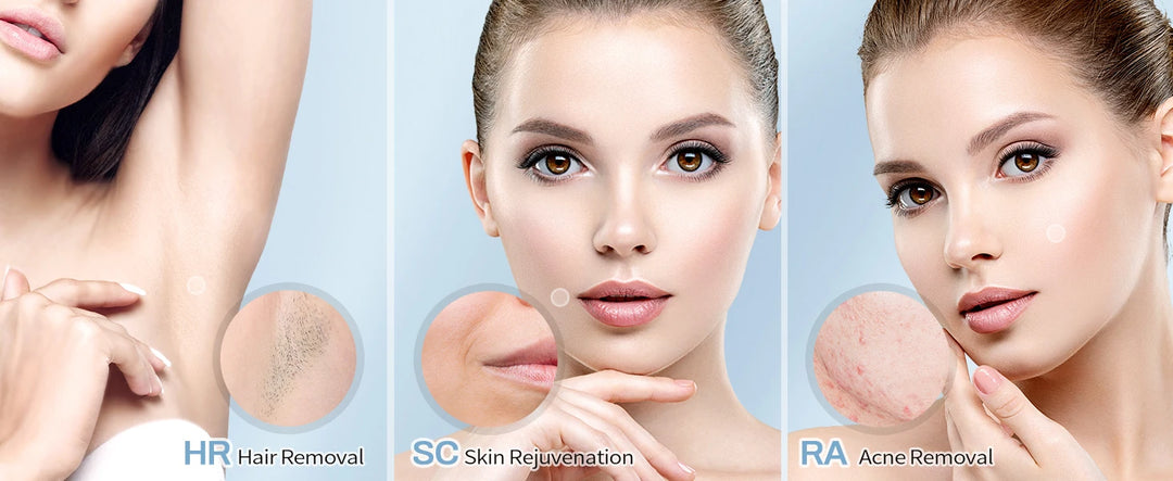 Epilateur Laser IPL 3 en 1 traitement permanent visage et corps